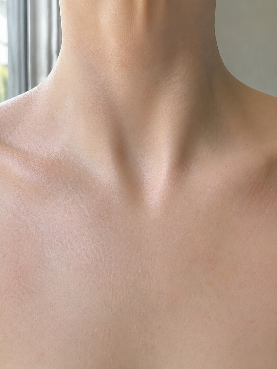 After applying Verlyn