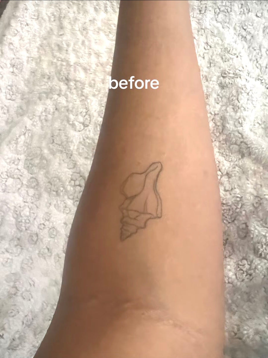 Before applying Verlyn