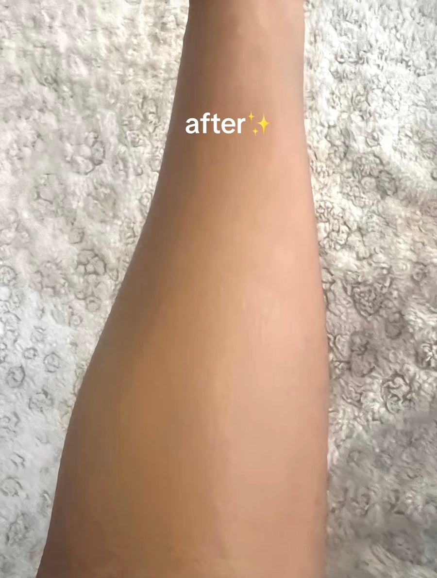 After applying Verlyn